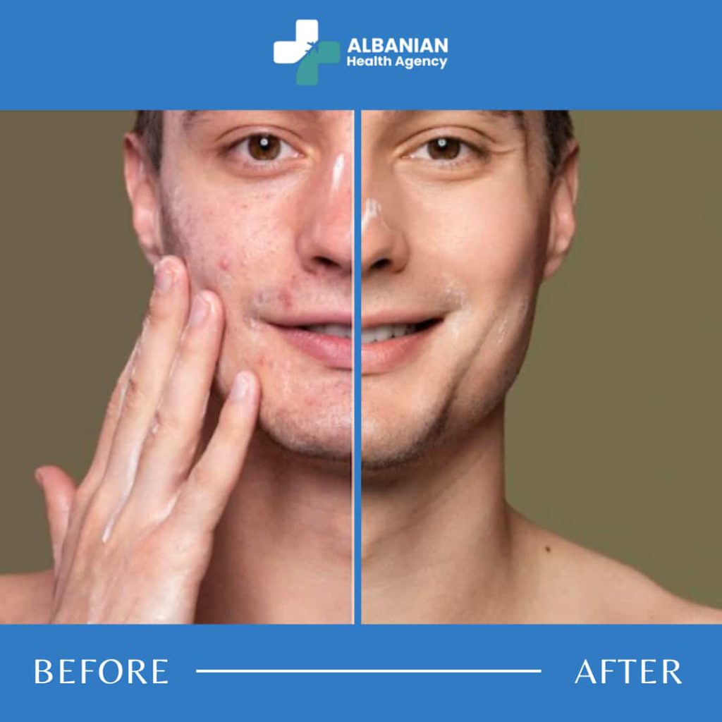 cosmetic-surgery-albania