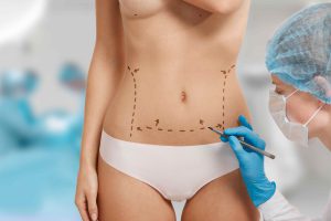 Body Surgery In Albania