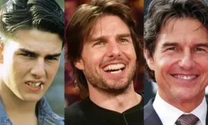 tom cruise teeth