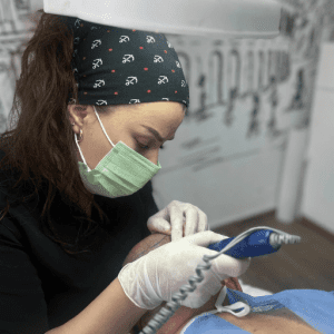 Trapianto Capelli Donne Albania