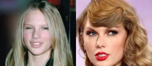 Taylor Swift Teeth Before and After