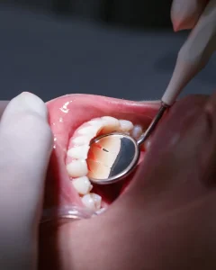 Periodontología en Albania