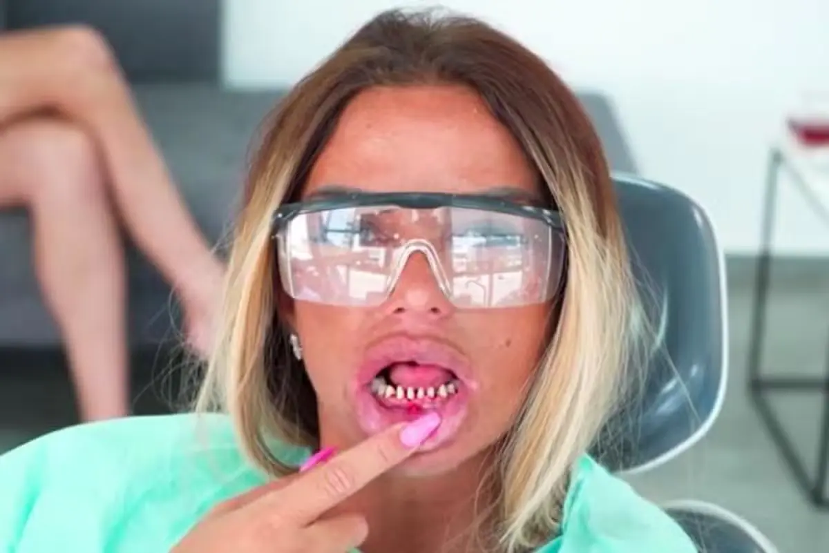 Katie Price denti