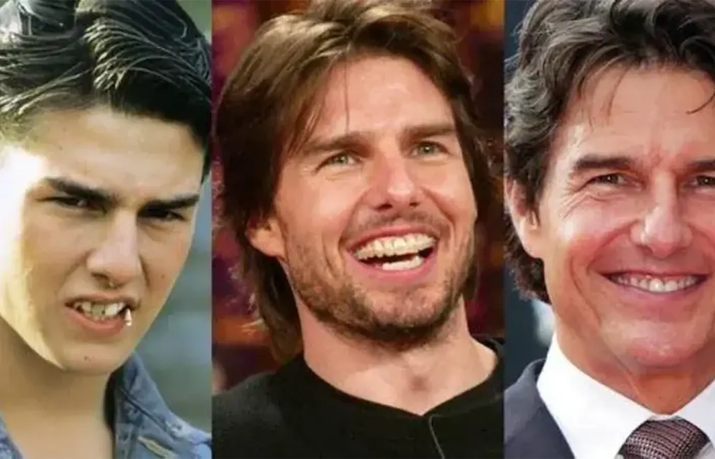 Dientes Tom Cruise