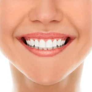 best teeth whitening products