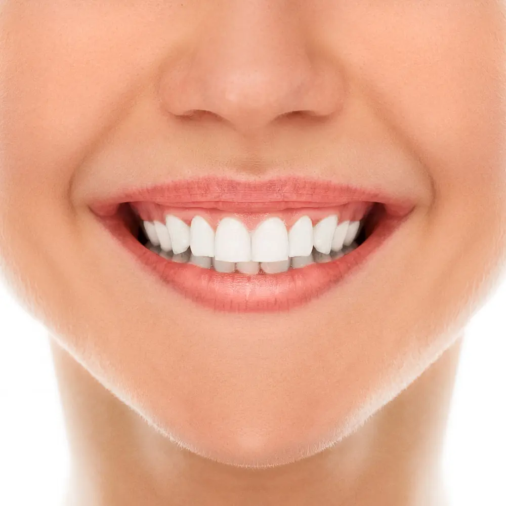 best teeth whitening products