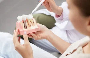 dental implants near me