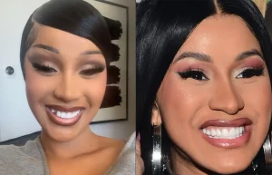 cardi b before after teeth