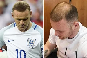 wayne rooney hair