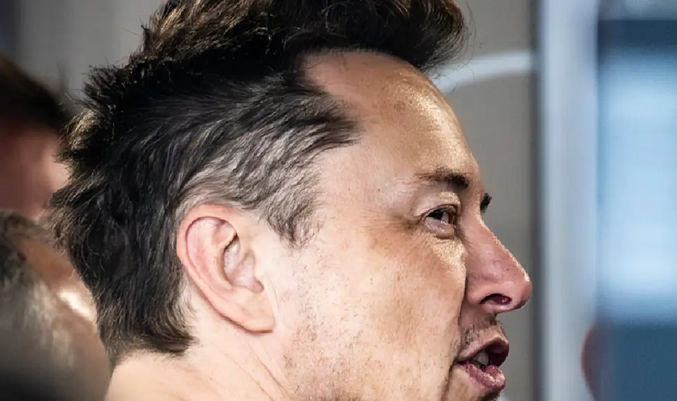 Trapianto di capelli Elon Musk