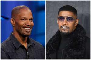 jamie Foxx hair transplant before and after