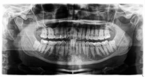 Discover the top 10 dental case studies of 2024, showcasing groundbreaking treatments and innovative solutions in modern dentistry.