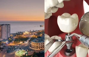 Looking for the best place to get your teeth done abroad? Discover why Albania offers top-quality dental care