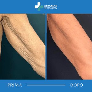 Trattamenti corpo in Albania