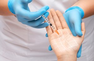Hyperhidrosis Treatment