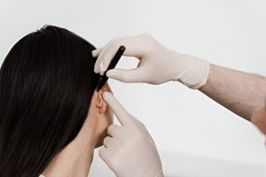 Otoplasty in Albania