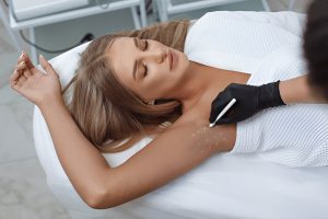 Trattamento dell'iperidrosi in Albania