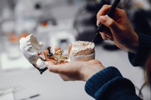 Scopri quanto tempo ci vuole per fare un impianto dentale, fase per fase. Informazioni mediche basate su fonti accademiche.