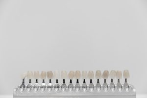 Corone Ceramiche vs Corone in Zirconio: scopri le differenze, i vantaggi e gli svantaggi per scegliere la soluzione migliore per te