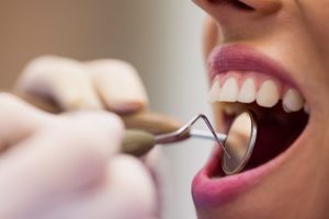 Scopri le migliori marche di impianti dentali per qualità e durata. Scegli il meglio per il tuo sorriso! Leggi di più qui!
