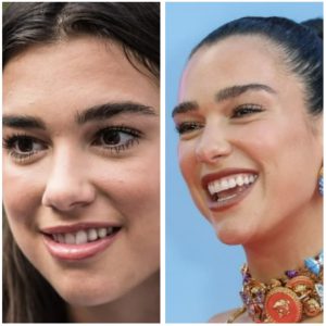 Discover how veneers transformed the smiles of 10 celebrities. Explore their before-and-after journeys and dental artistry