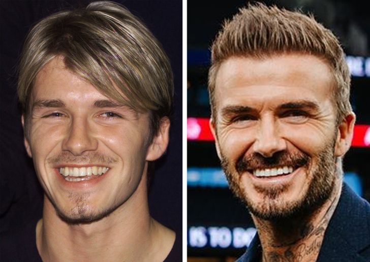 Discover how David Beckham transformed his teeth over the years. From orthodontics to whitening, explore his dental makeover in detail.