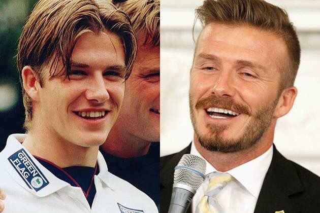david beckham teeth before and after