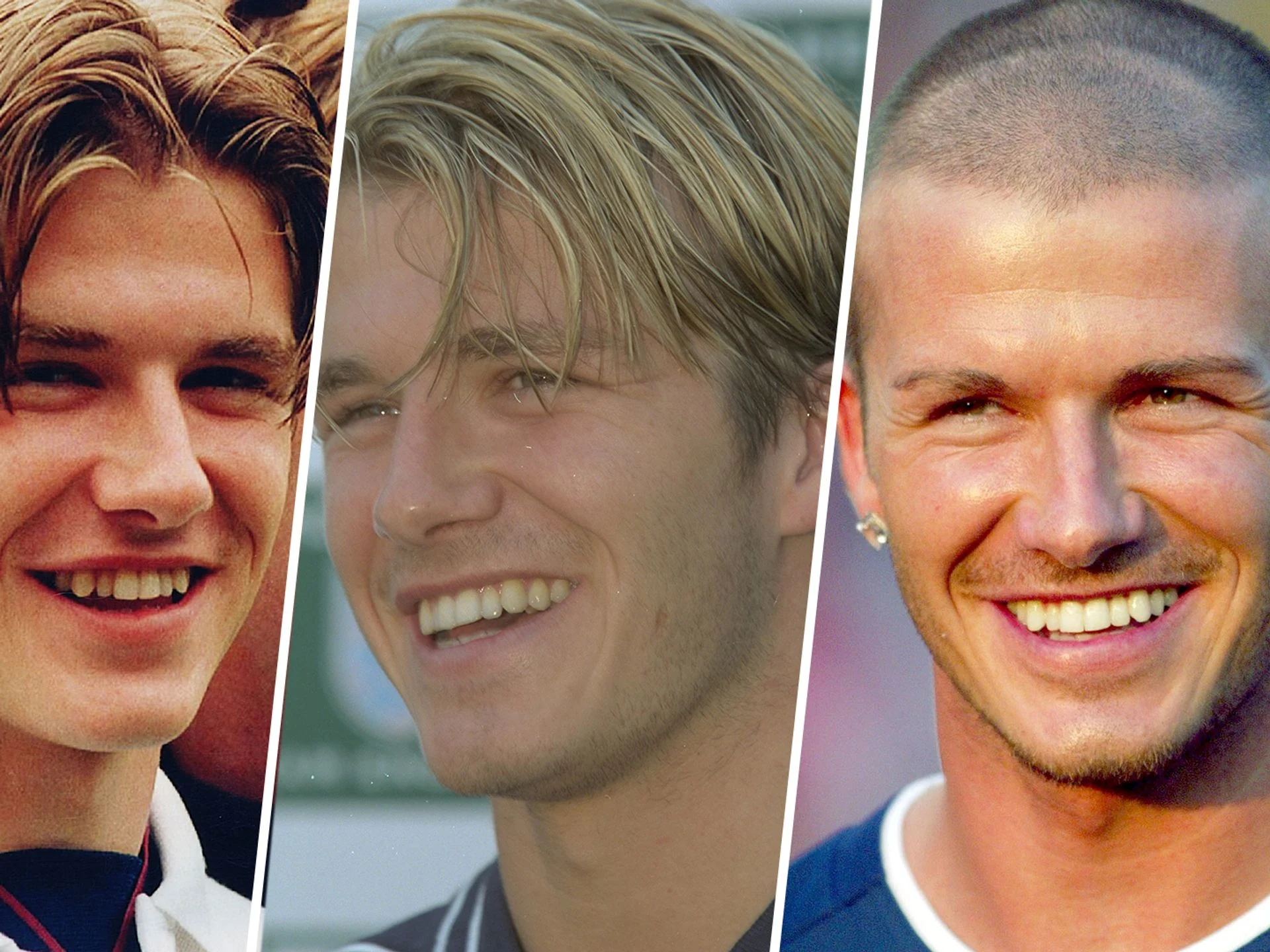 david beckham teeth before and after