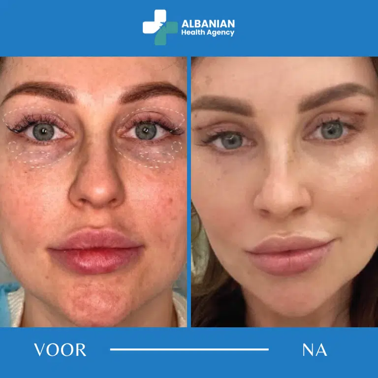Esthetische behandelingen in Albanië