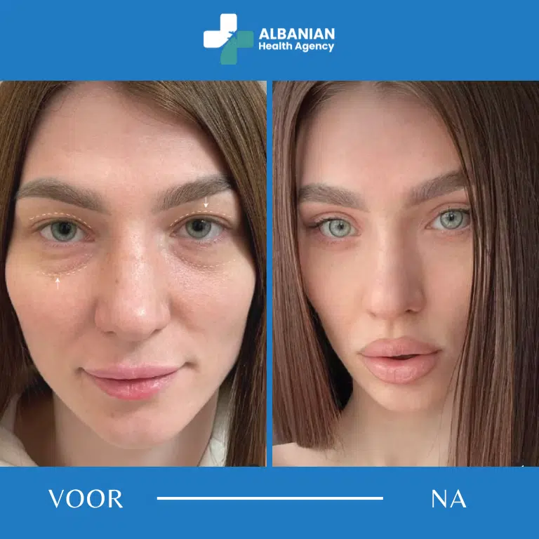 Lip- en kincontouring
