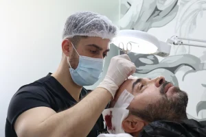 Ontdek haartransplantatie met DHI in Albanië: effectieve, innovatieve behandeling met ervaren specialisten en betaalbare prijzen.