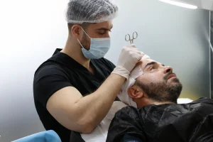 Haartransplantatie met FUE in Albanië: natuurlijke resultaten, moderne klinieken en betaalbare prijzen met volledige begeleiding.