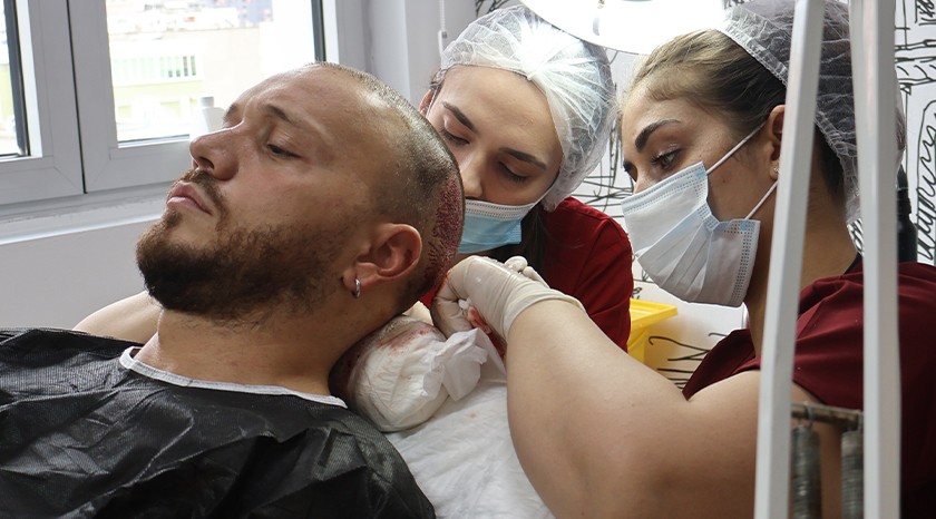 Haartransplantatie verzorgd via een betrouwbaar medisch toerismebureau met ervaren specialisten in Albanië.