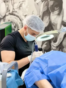 Haartransplantatie met FUE in Albanië