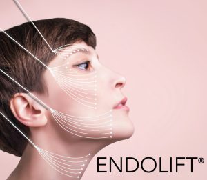 Endolift® – The Non-Surgical Laser Lift