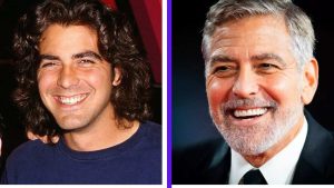 Discover the teeth transformation of George Clooney. Learn how dental implants shaped his smile and how you can achieve similar results.
