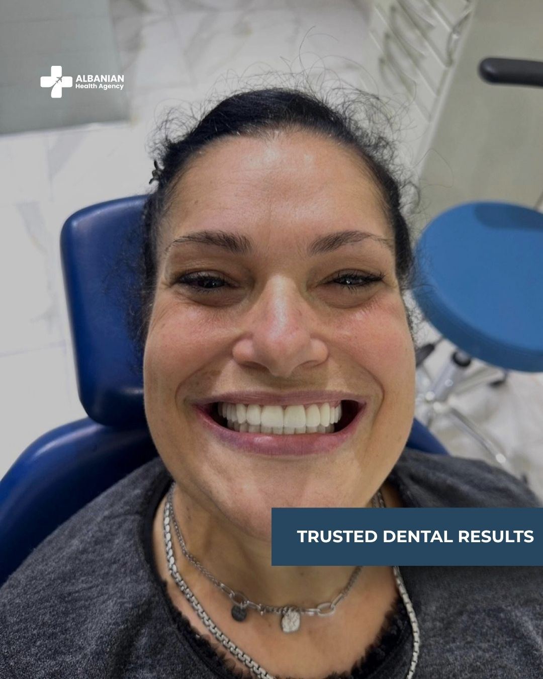 Trusted Dental Results 🦷✨Another happy smile delivered by our expert team at Albanian Health Ag