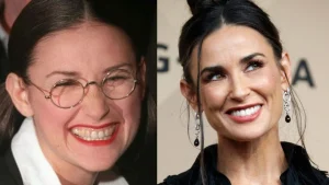 Discover the real story of Demi Moore’s teeth transformation, how stress caused her front tooth loss, and how dentistry restored her smile.