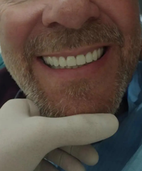 Albania dental agengy post (1)