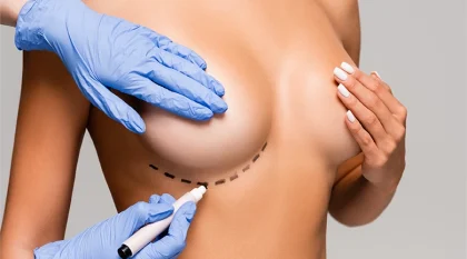 Breast-Lift