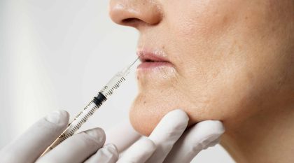 BOTOX E FILLERS in aLBANIA